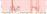 ping.png